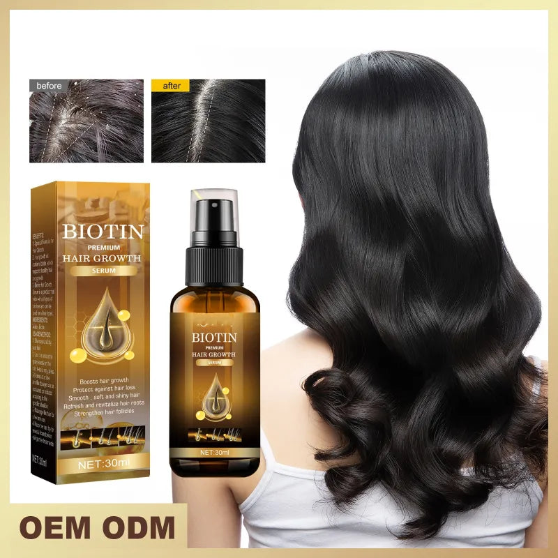 Biotin Hair Growth Spray | Strengthens, Thickens & Stimulates Growth | 30ml