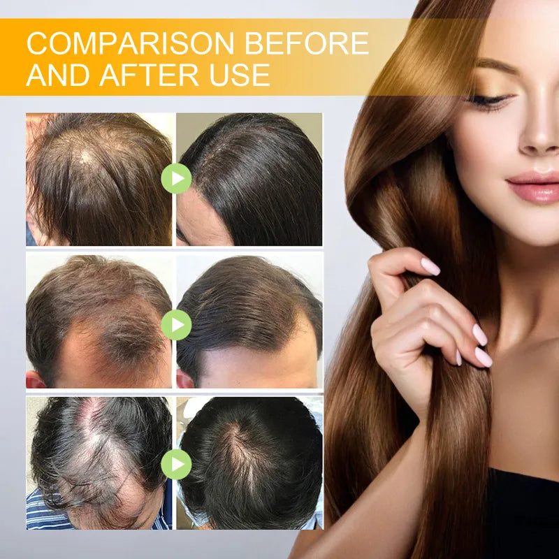 Biotin Hair Growth Spray | Strengthens, Thickens & Stimulates Growth | 30ml