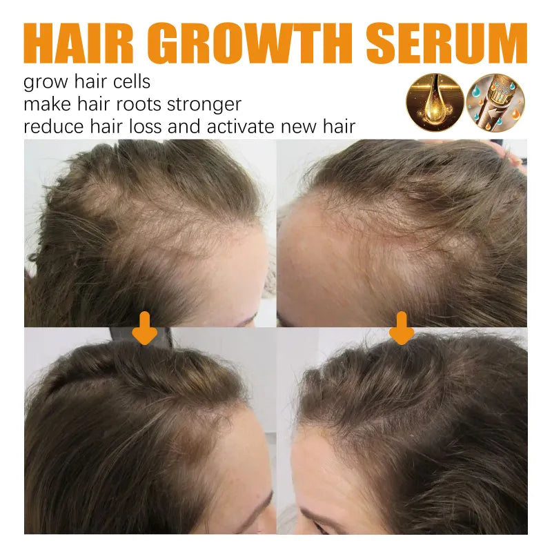 Biotin Hair Growth Spray | Strengthens, Thickens & Stimulates Growth | 30ml